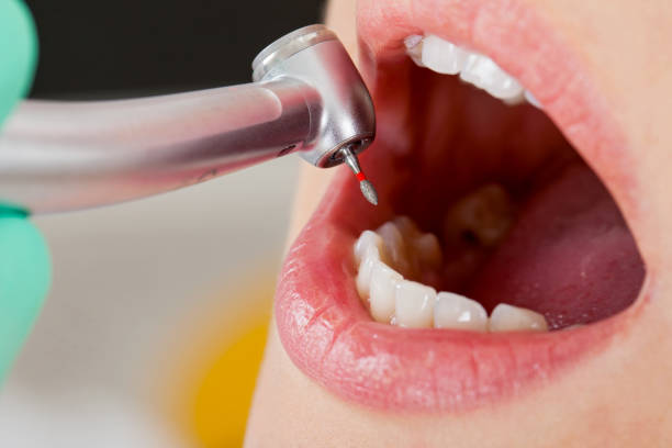 Urgent Tooth Repair Sandy Valley, NV